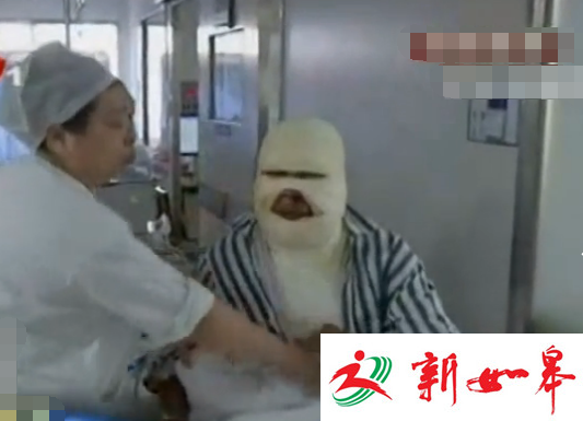 如皋丁堰男子庆生烟花炸伤家人　面部大面积烧伤满脸鲜血-雉水网