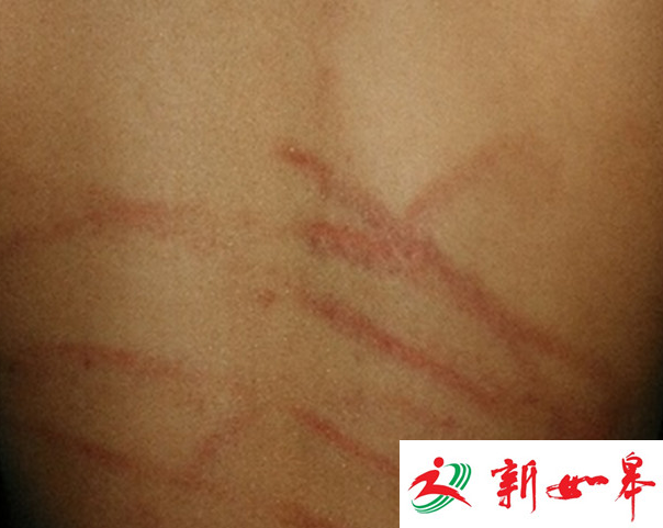 小学生疑因未做作业被老师抽打 家长回应现反转-雉水网