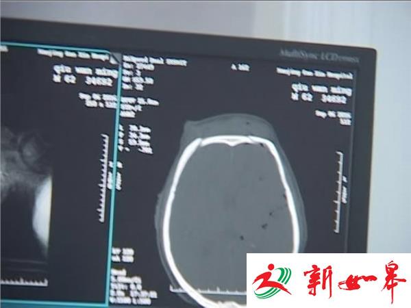 拆墙安全措施不到位 墙体倒塌5人被埋2人重伤-雉水网