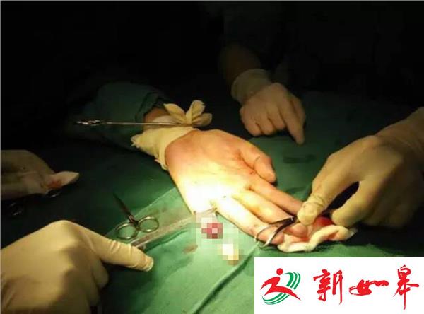 盐城响水邻居之间为停车 一男子咬断他人手指-雉水网