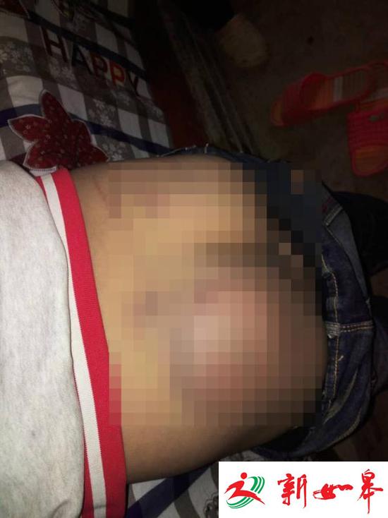 甘肃回应村小教师体罚学生事件：涉事教师被记过-雉水网