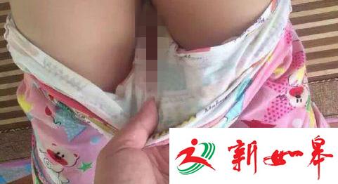 5岁女童下体青肿流血称摔伤 幼儿园视频少4分钟-雉水网