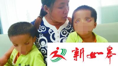 贵州双胞胎患病眼睛似外星人:无眼睑瞳孔上翻-雉水网