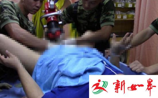 男子下身被强力磁铁夹4个多小时 现场堪比接生-雉水网