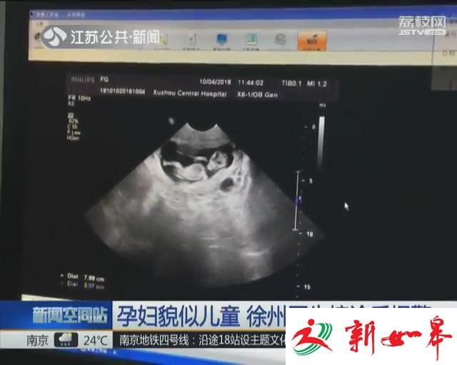 孕妇貌似儿童  徐州医生接诊后报警-雉水网