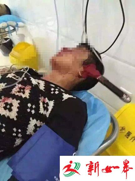 慎入！连云港一男子与人打架，被匕首插头上-雉水网