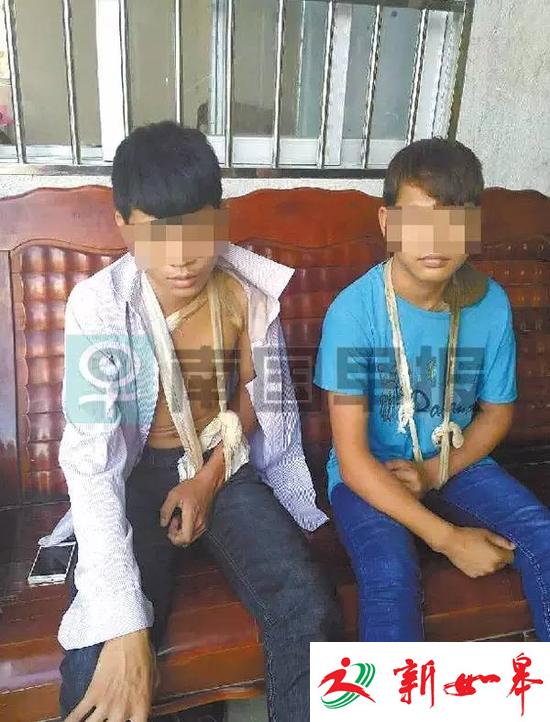 2名少年遭人敲断锁骨被逼去碰瓷 6天狂碰瓷9单-雉水网