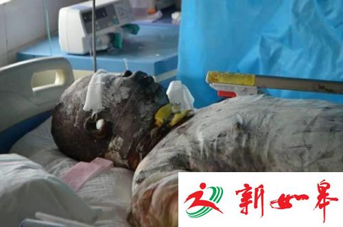 河南救火英雄王锋抢救无效离世 曾火海中救出6人-雉水网