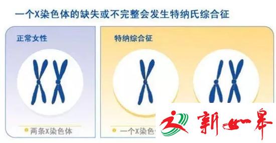 女子22岁从没来过