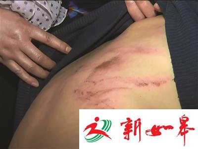 南京一男子口角招祸 被十几人持橡胶棍殴-雉水网