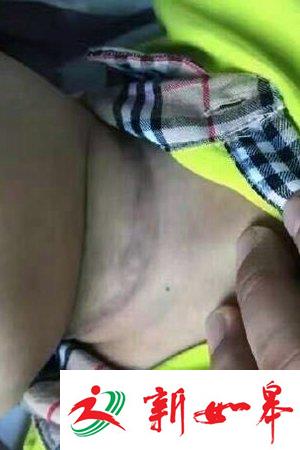 男童在幼儿园窒息身亡脖子现勒痕 警方排除他杀-雉水网