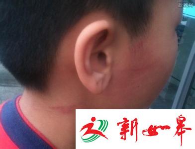 湖南19名小学生被逼自抽耳光 涉事代课教师被辞退-雉水网