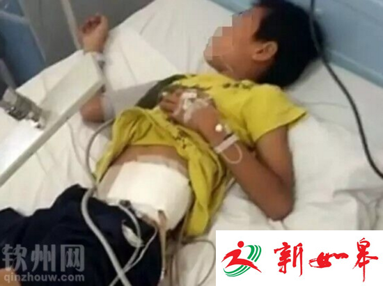 广西一老师疑脚踢学生 致学生肾脏破裂并摘除-雉水网