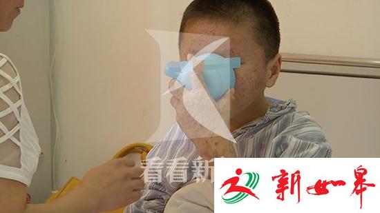 12岁男孩生怪病皮肤如蟾蜍 全身长满疙瘩-雉水网
