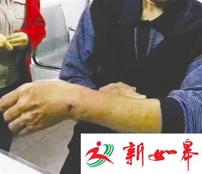 四川阆中：流浪狗连伤22人 疑似狗终被捕杀-雉水网