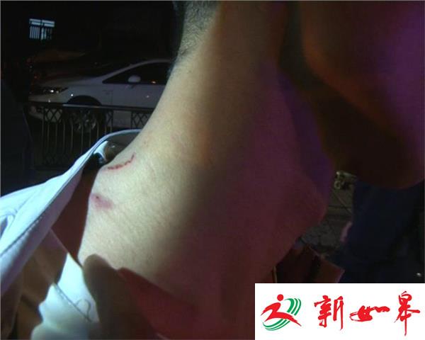 深夜两车碰擦 疑似“顶包”被查-雉水网