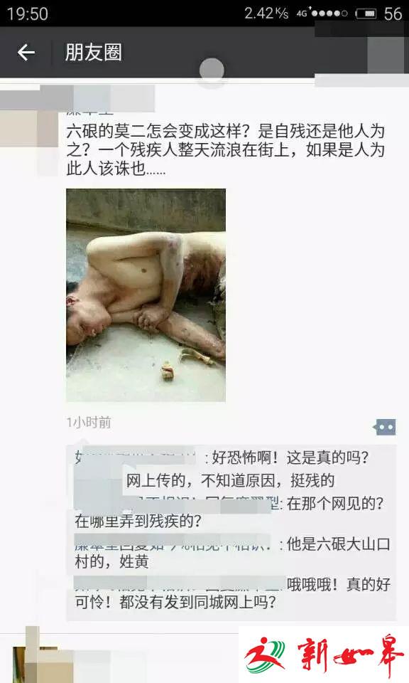 广西一流浪汉无故被泼汽油烧伤，纵火者竟是几个孩子！-雉水网