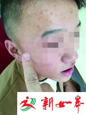 为多获8万元赔偿 画条伤疤去鉴定-雉水网