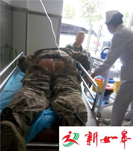 工人从脚手架上摔下 长 20 多公分钢筋插入肛门！-雉水网