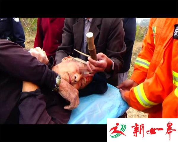 钉耙插入眉头 消防及时救援-雉水网