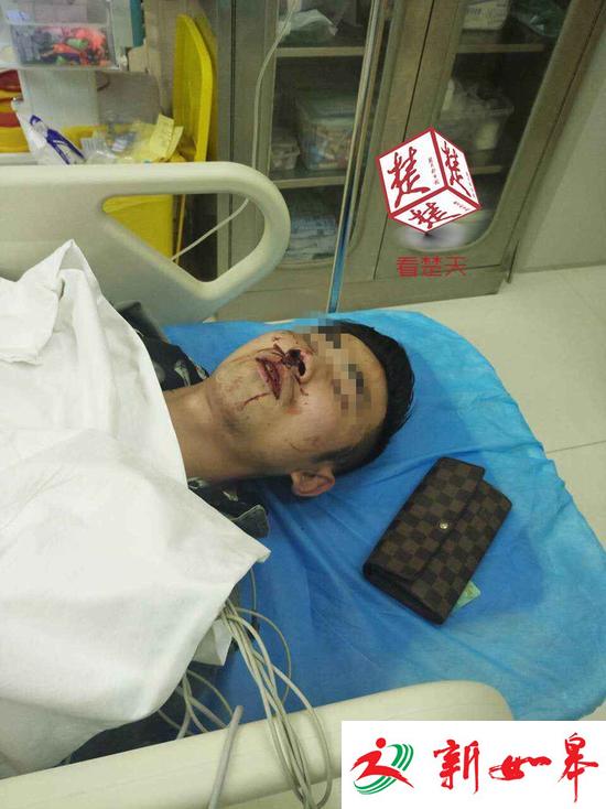 情侣深夜电梯遇一群醉汉 女子遭咸猪手男友被围殴-雉水网