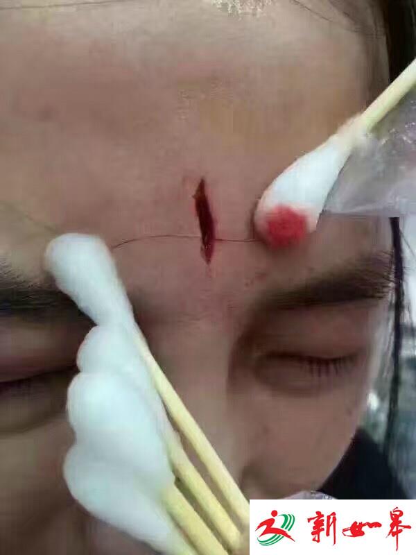 在儿童医院发飙拿ipad砸破护士头，她被拘留又判赔2.3万-雉水网