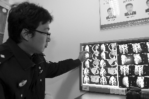 南京独居一男子死于火场 法医巧断“谋杀案”-雉水网