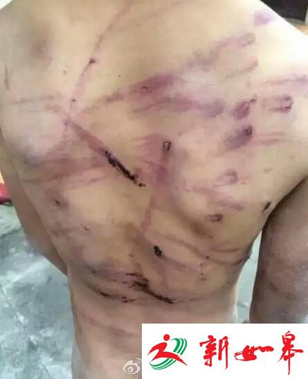 9岁男童遭父亲皮线抽打并脱光撵出家 警方:已教育-雉水网