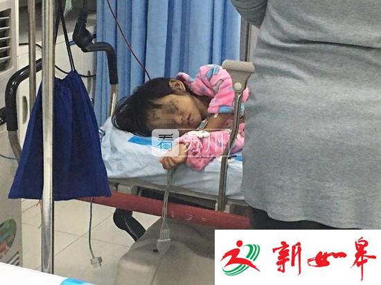 4岁女童被亲生母亲殴打致重伤-雉水网