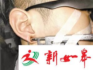 一男子赶时髦打耳洞 却被耳钉枪咬住不放-雉水网