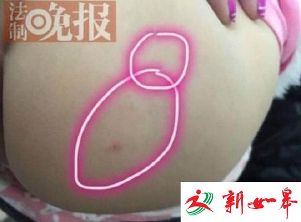 谁不听话就扎谁？吉林4名幼教因针刺儿童被判刑-雉水网