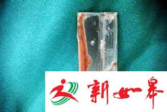 男子用刀片自伤谎称风扇坠落 敲诈3家招待所-雉水网