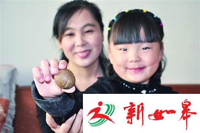 村民宰羊时发现50余克结石 价值达到上百万-雉水网