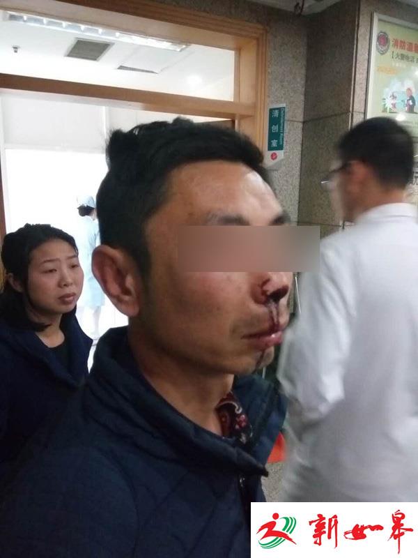 连云港一快递员称叫收件人实名签收遭暴打 警方：已立案-雉水网