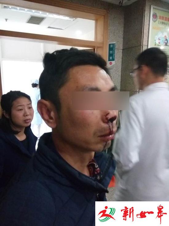 快递员叫收件人实名签收遭暴打 警方：已立案调查-雉水网