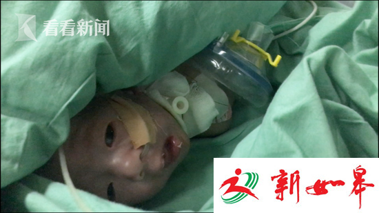 失独母亲诞下龙凤胎 儿子发育不良第三次接受手术-雉水网