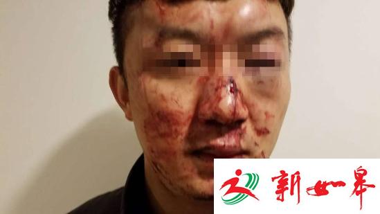 醉酒男错把访客当小偷毒打 逼其只穿内裤蹲马步-雉水网