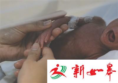 成都“巴掌公主”出生仅1斤4两 等同一瓶矿泉水-雉水网