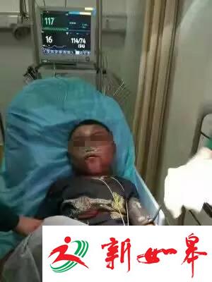 无锡13岁孩子被后妈打成“大头娃”？真相其实是……-雉水网