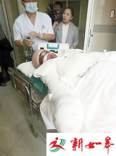 少女为救父亲烧伤手术成功 已申请微博公布开支-雉水网