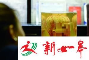 整容医生朋友圈公然叫卖尸头标本-雉水网