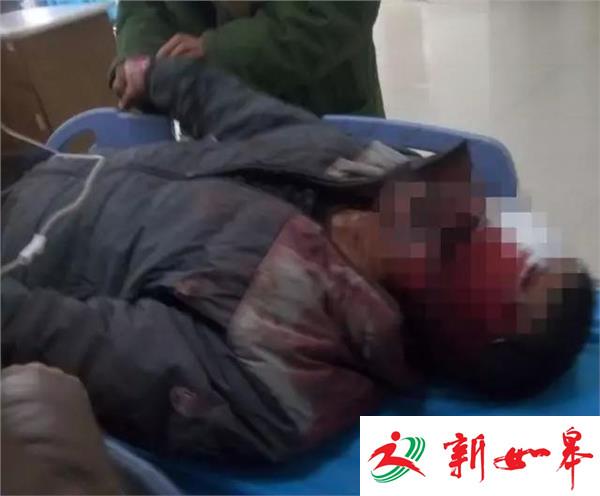 一男子浑身是血受重伤 警方已介入调查-雉水网