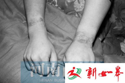 男孩精神分裂被锁小屋447天 母亲：打伤别人谁抵命-雉水网