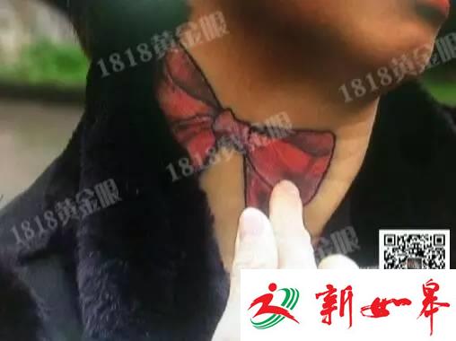 怀孕后她在脖子上纹了个蝴蝶结 结果孩子没了-雉水网