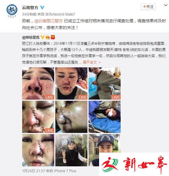 女子称丽江游玩时遭十余人暴打 警方已回应-雉水网