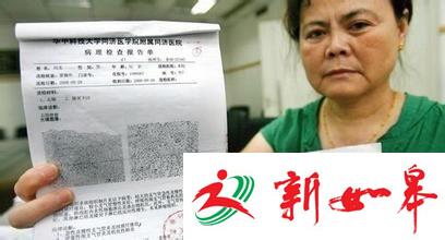 女子查出癌症复发放疗后被告知无癌 医院：过度诊断-雉水网