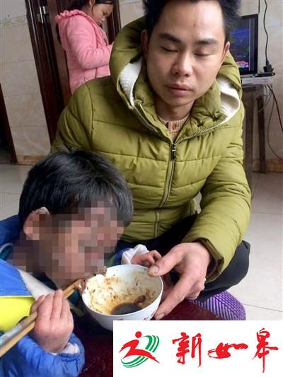 父母近亲结婚 男童患绝症满脸长黑色异物-雉水网