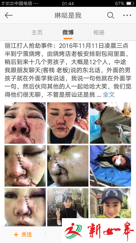 丽江被打毁容女子：我绝对没有骂过丽江-雉水网