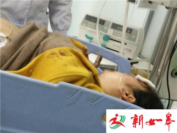 惊险！孕妇骑车摔倒树棍戳进脖子-雉水网