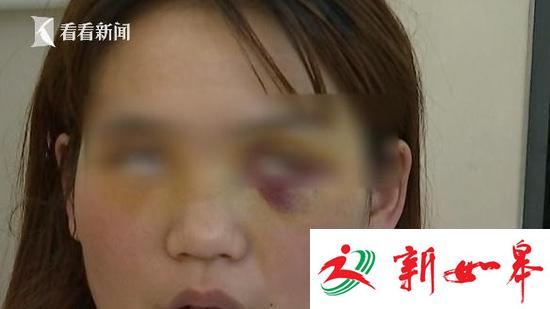 女子割双眼皮后眼睛睁不开 无照医生赔1万失联-雉水网